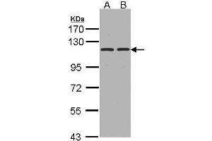 WB Image Sample(30 ug whole cell lysate) A:Hep G2 , B:HeLa S3, 7. (ENPEP 抗体  (C-Term))