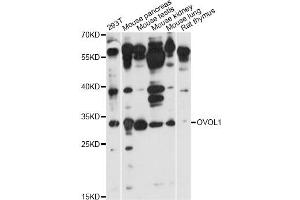 Western blot analysis of extracts of various cell lines, using OVOL1 antibody (ABIN6293430) at 1:1000 dilution. (OVOL1 抗体)