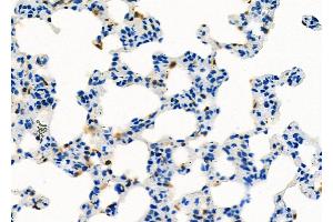 ABIN6260031 and ABIN6273193 at 1/100 staining Rat lung tissue by IHC-P.