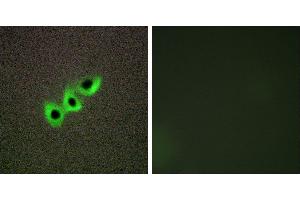 Peptide - +Immunohistochemistry analysis of paraffin-embedded human prostate carcinoma tissue, using RHG07 antibody. (DLC1 抗体)