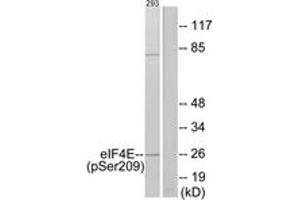 Western blot analysis of extracts from 293 cells treated with Anisomycin 25ug/ml 30', using eIF4E (Phospho-Ser209) Antibody. (EIF4E 抗体  (pSer209))
