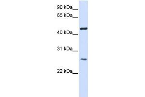 WB Suggested Anti-TMEM127 Antibody Titration:  0. (TMEM127 抗体  (Middle Region))