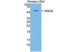 Detection of Recombinant ALDH1A, Human using Polyclonal Antibody to Aldehyde Dehydrogenase 1 Family, Member A2 (ALDH1A2) (ALDH1A2 抗体  (AA 1-422))