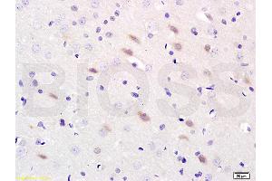 Formalin-fixed and paraffin-embedded : rat brain labeled with Rabbit Anti-NOS-2/iNOS Polyclonal Antibody, Unconjugated (ABIN677228) 1:200 followed by conjugation to the secondary antibody and DAB staining (NOS2 抗体  (AA 14-100))