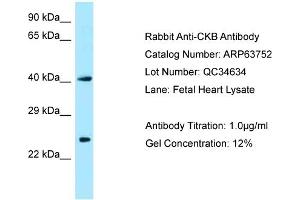 Western Blotting (WB) image for anti-Creatine Kinase, Brain (CKB) (N-Term) antibody (ABIN2789612) (CKB 抗体  (N-Term))