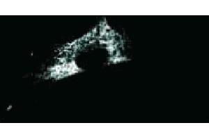 Immunoflourescence staining of the human lung cell line, WI38. (Calreticulin 抗体  (AA 270-390))