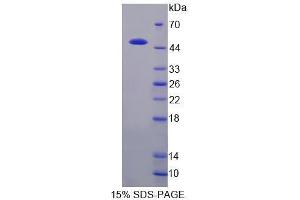Image no. 1 for Casein kappa (CSN3) (AA 22-190) protein (His tag,GST tag) (ABIN6237587) (CSN3 Protein (AA 22-190) (His tag,GST tag))
