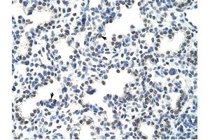 HNRPLL antibody was used for immunohistochemistry at a concentration of 4-8 ug/ml to stain Alveolar cells (arrows) in Human Lung. (HNRPLL 抗体  (N-Term))
