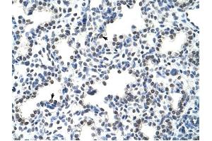 HNRPLL antibody was used for immunohistochemistry at a concentration of 4-8 ug/ml to stain Alveolar cells (arrows) in Human Lung.