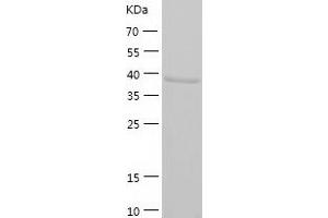 Western Blotting (WB) image for Guanine Nucleotide Binding Protein (G Protein), Q Polypeptide (GNAQ) (AA 1-359) protein (His tag) (ABIN7286333) (GNAQ Protein (AA 1-359) (His tag))