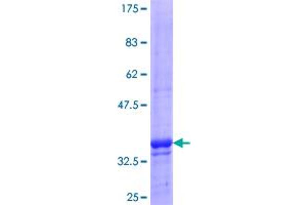 POLRMT Protein (AA 1-100) (GST tag)