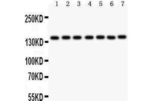 Western Blotting (WB) image for anti-Poly (ADP-Ribose) Polymerase 1 (PARP1) (AA 670-858) antibody (ABIN3043378) (PARP1 抗体  (AA 670-858))