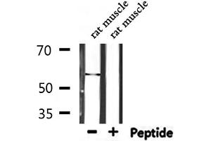 Western blot analysis of extracts from rat muscle, using TPH1  Antibody. (Tryptophan Hydroxylase 1 抗体  (Internal Region))