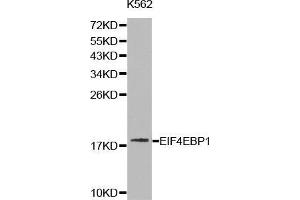 Western blot analysis of K562 cell lysate using EIF4EBP1 antibody. (eIF4EBP1 抗体  (C-Term))