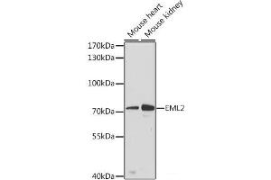 Western blot analysis of extracts of various cell lines using EML2 Polyclonal Antibody at dilution of 1:3000. (EML2 抗体)