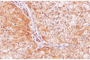 Immunohistochemistry of paraffin-embedded Human liver using IL2 Polyclonal Antibody at dilution of 1:100 (IL-2 抗体)