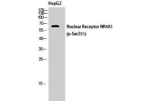 Western Blotting (WB) image for anti-Nuclear Receptor Subfamily 4, Group A, Member 1 (NR4A1) (pSer351) antibody (ABIN3182893) (NR4A1 抗体  (pSer351))
