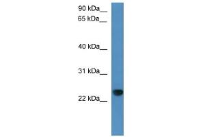 WB Suggested Anti-Capsl Antibody Titration: 0. (CAPSL 抗体  (C-Term))