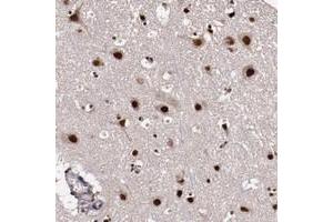 Immunohistochemical staining of human cerebral cortex with CECR2 polyclonal antibody  shows strong nuclear and cytoplasmic positivity in neuronal cells. (CECR2 抗体)
