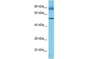 Host:  Rabbit  Target Name:  IFIT3  Sample Tissue:  Human PANC1 Whole Cell  Antibody Dilution:  1ug/ml