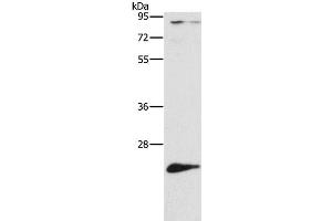 Western Blot analysis of Mouse liver tissue using ATG10 Polyclonal Antibody at dilution of 1:500 (ATG10 抗体)
