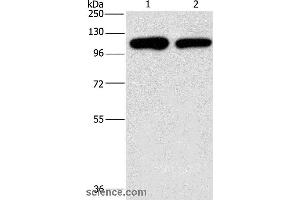 Western blot analysis of A431 and hela cell, using PIP5K1C Polyclonal Antibody at dilution of 1:500 (PIP5K1C 抗体)