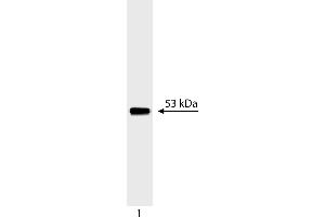 Western Blotting (WB) image for anti-Tumor Protein P53 (TP53) (AA 14-289) antibody (ABIN967419) (p53 抗体  (AA 14-289))