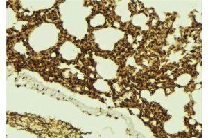 ABIN6273100 at 1/100 staining Mouse lung tissue by IHC-P. (CHMP4B 抗体  (N-Term))