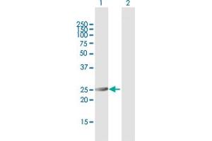 Western Blot analysis of PSMA6 expression in transfected 293T cell line by PSMA6 MaxPab polyclonal antibody. (PSMA6 抗体  (AA 1-246))