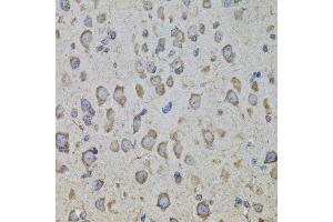 Immunohistochemistry (Paraffin-embedded Sections) (IHC (p)) image for anti-Corticotropin Releasing Hormone Receptor 1 (CRHR1) (AA 24-120) antibody (ABIN6139034)