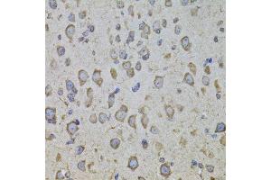 Immunohistochemistry of paraffin-embedded mouse brain using CRHR1 antibody. (CRHR1 抗体  (AA 24-120))