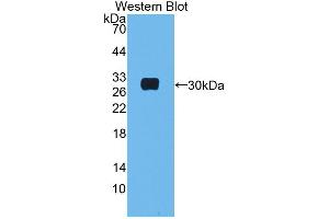 Western blot analysis of the recombinant protein. (MBL2 抗体  (AA 19-244))