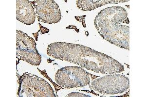 IHC analysis of COMT using anti-COMT antibody (ABIN7601948).