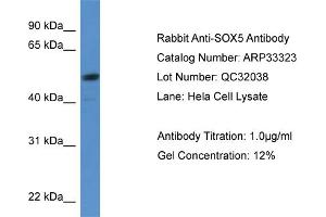 WB Suggested Anti-SOX5 Antibody Titration:  0. (SOX5 抗体  (C-Term))