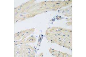 Immunohistochemistry of paraffin-embedded mouse heart using LEPREL2 antibody (ABIN6293155) at dilution of 1:200 (40x lens). (LEPREL2 抗体)