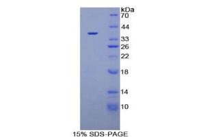 SDS-PAGE (SDS) image for Plasminogen (PLG) ELISA Kit (ABIN6574264)