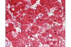 Human Adrenal: Formalin-Fixed, Paraffin-Embedded (FFPE)