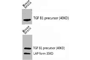 Western Blot analysis of mouse-brain using TGFβ1 Polyclonal Antibody. (TGFB1 抗体  (C-Term))