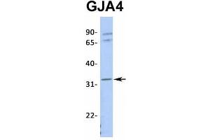 Host:  Rabbit  Target Name:  GJA4  Sample Type:  721_B  Antibody Dilution:  1. (GJA4 抗体  (Middle Region))