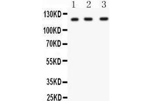 Anti- HIF 1 alpha Picoband antibody, Western blotting All lanes: Anti HIF 1 alpha  at 0. (HIF1A 抗体  (C-Term))