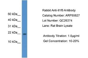WB Suggested Anti-Il1f5  Antibody Titration: 0. (FIL1d 抗体  (C-Term))