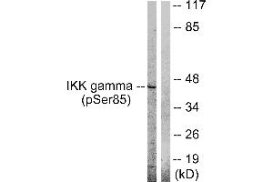Western blot analysis of extracts from HepG2 cells, treated with Anisomycin (0. (IKBKG 抗体  (pSer85))