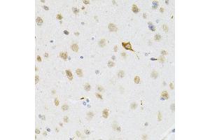 Immunohistochemistry of paraffin-embedded mouse brain using SYK Antibody (ABIN5971150) at dilution of 1/100 (40x lens). (SYK 抗体)
