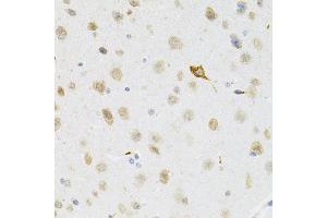 Immunohistochemistry of paraffin-embedded mouse brain using SYK Antibody (ABIN5971150) at dilution of 1/100 (40x lens). (SYK 抗体)