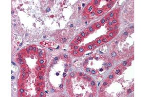 Immunohistochemistry (IHC) image for anti-Albumin (ALB) (Middle Region) antibody (ABIN2776970) (Albumin 抗体  (Middle Region))