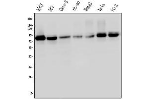 Western blot analysis of MED15 using anti-MED15 antibody (ABIN6719342).