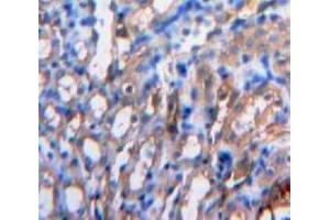 IHC-P analysis of Kidney tissue, with DAB staining. (IL-15 抗体  (AA 49-162))