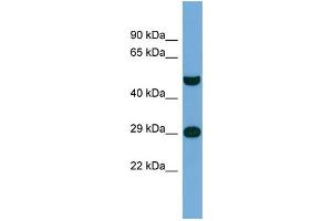 Host:  Rabbit  Target Name:  NPAS3  Sample Type:  THP-1 Whole Cell lysates  Antibody Dilution:  1. (NPAS3 抗体  (Middle Region))