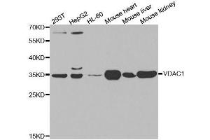 Western Blotting (WB) image for anti-Voltage-Dependent Anion Channel 1 (VDAC1) (AA 1-283) antibody (ABIN3021131)