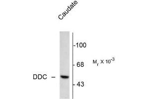 Image no. 1 for anti-Dopa Decarboxylase (Aromatic L-Amino Acid Decarboxylase) (DDC) (N-Term) antibody (ABIN372610) (DDC 抗体  (N-Term))